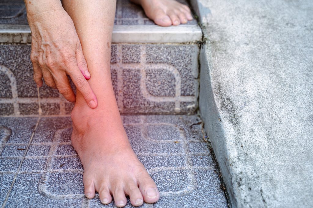 Foot Drop - Walking Problems - Symptoms - Neurological - What We Treat 