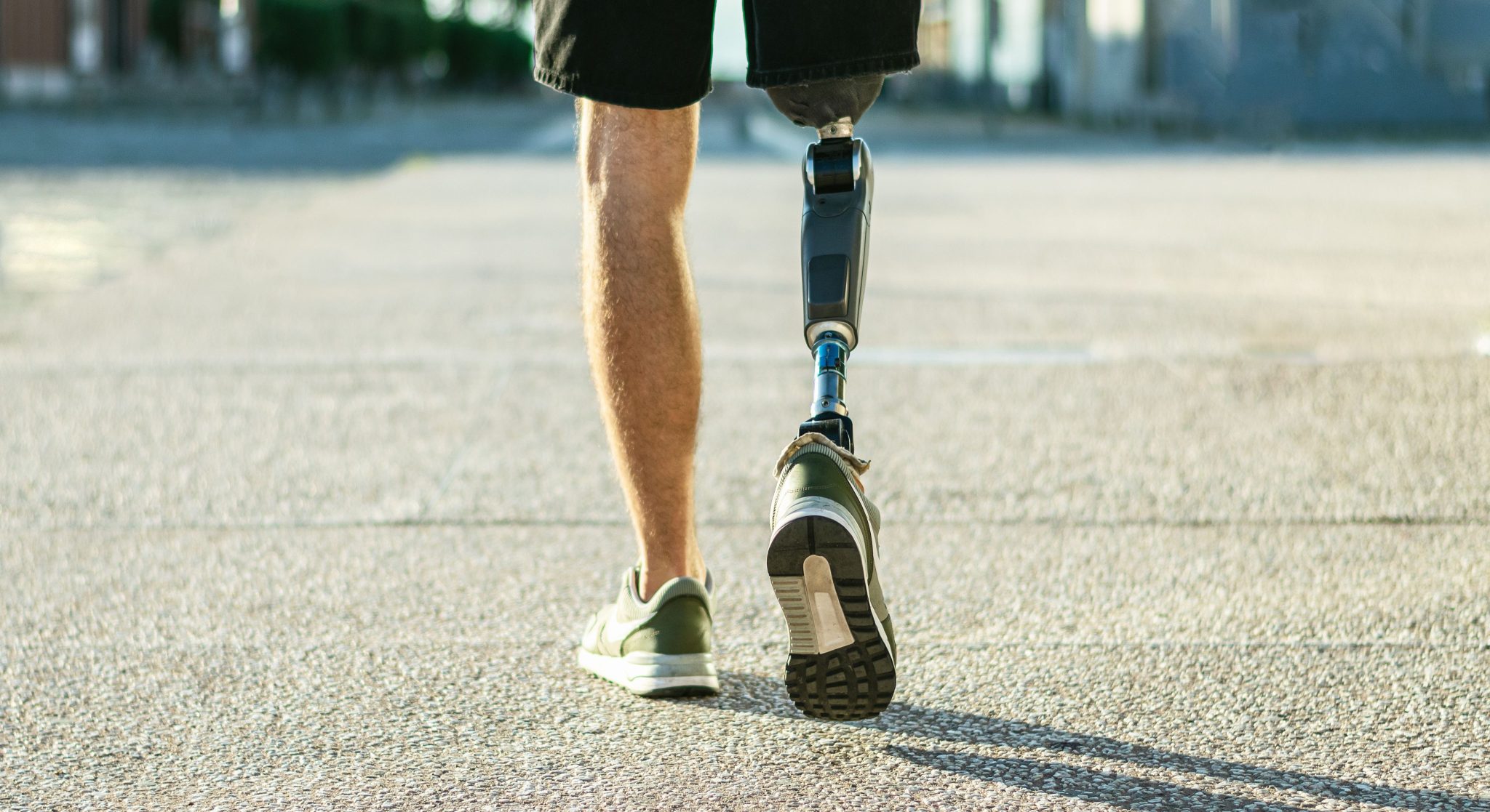 How The Right Prosthetic Device Can Improve Your Quality Of Life